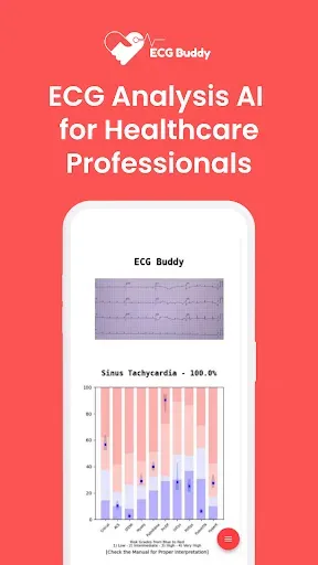 Скриншот 1 — ECG Buddy | ECG Analysis AI