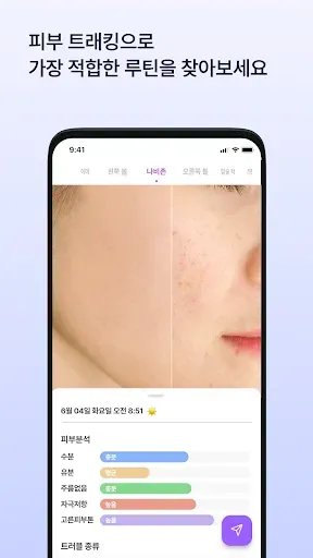 Скриншот 5 — SkinLog | Дневник прыщей