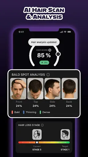 Скриншот 2 — HairCode·Hair Loss Scanner AI