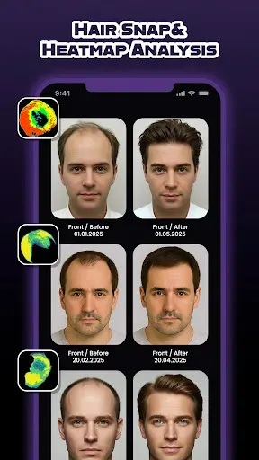 Скриншот 3 — HairCode·Hair Loss Scanner AI