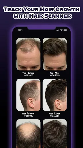 Скриншот 6 — HairCode·Hair Loss Scanner AI