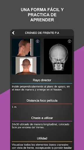 Скриншот 3 — RX - Posiciones Radiológicas