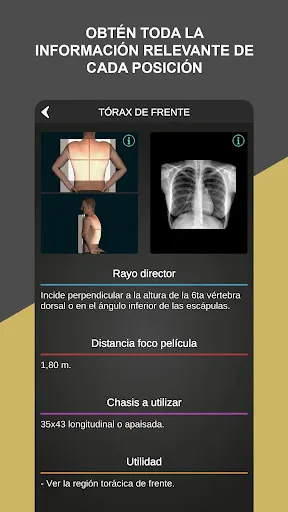 Скриншот 4 — RX - Posiciones Radiológicas