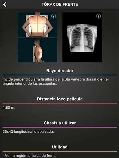 Скриншот 8 — RX - Posiciones Radiológicas