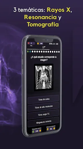 Скриншот 2 — RX Trivia - Quiz de Radiología