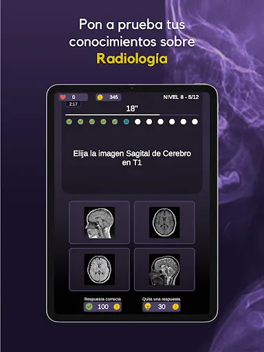 Скриншот 6 — RX Trivia - Quiz de Radiología
