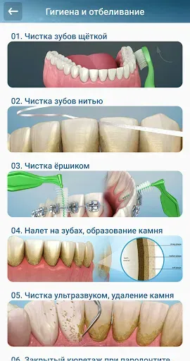 Скриншот 3 — Стоматология - 3D иллюстрации