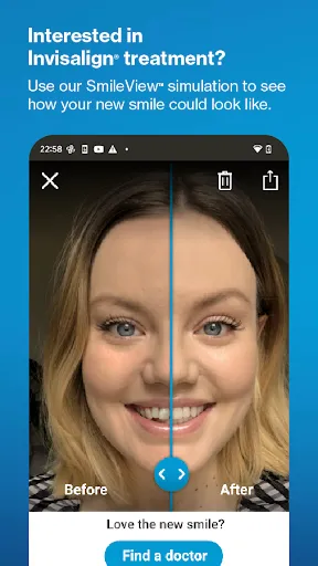 Скриншот 1 — My Invisalign