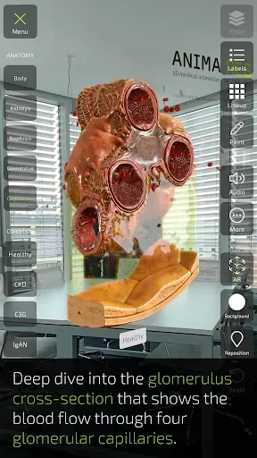 Скриншот 6 — INSIGHT KIDNEY