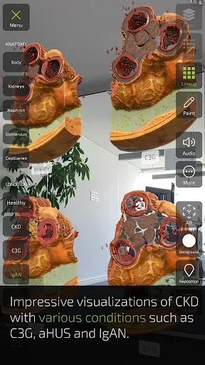 Скриншот 7 — INSIGHT KIDNEY