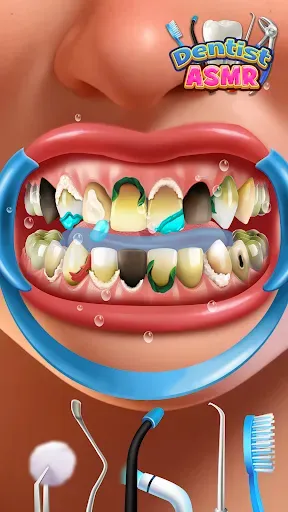Скриншот 2 — Dentist Office: Root Canal Sim