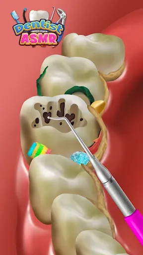 Скриншот 3 — Dentist Office: Root Canal Sim