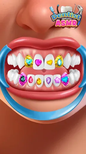Скриншот 5 — Dentist Office: Root Canal Sim
