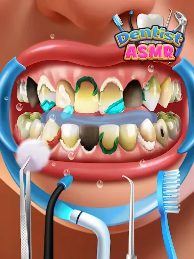 Скриншот 8 — Dentist Office: Root Canal Sim