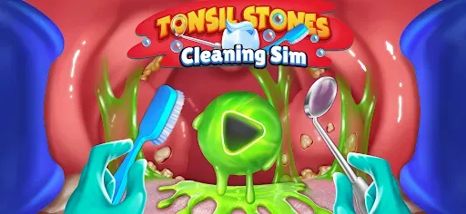 Скриншот 1 — Tonsil Stones Simulator