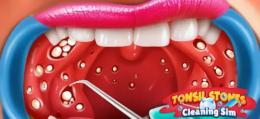 Скриншот 2 — Tonsil Stones Simulator