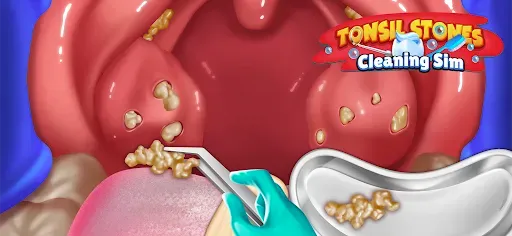 Скриншот 3 — Tonsil Stones Simulator