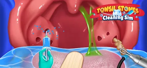 Скриншот 5 — Tonsil Stones Simulator