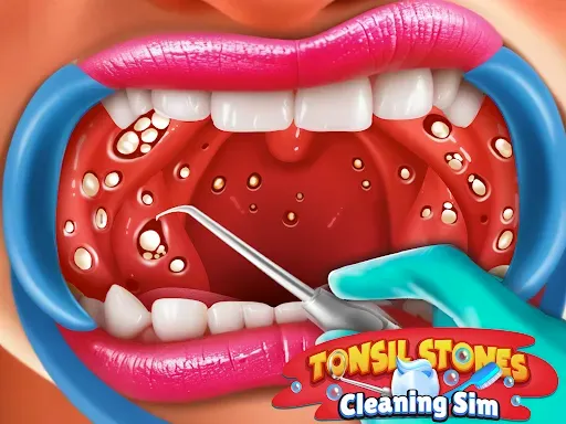 Скриншот 6 — Tonsil Stones Simulator