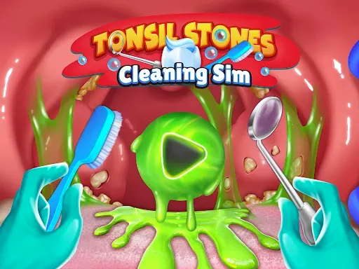 Скриншот 8 — Tonsil Stones Simulator