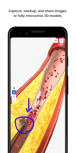 Скриншот 5 — BioDigital Human - 3D Anatomy