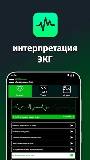 Скриншот 1 — Академия ЭКГ | Простое ЭКГ