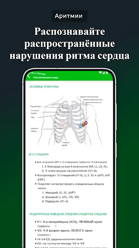 Скриншот 4 — Академия ЭКГ | Простое ЭКГ