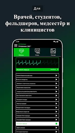 Скриншот 8 — Академия ЭКГ | Простое ЭКГ