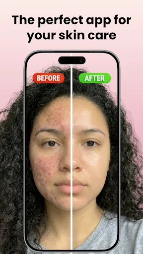 Скриншот 1 — Skin Care Scanner: GlowUp
