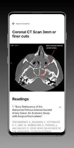Скриншот 3 — Sinus Surgery CT Checklist