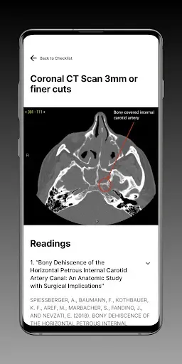 Скриншот 8 — Sinus Surgery CT Checklist