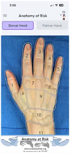 Скриншот 1 — Anatomy at Risk