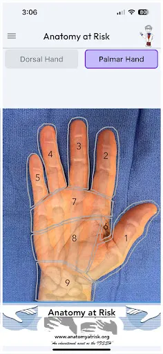 Скриншот 2 — Anatomy at Risk