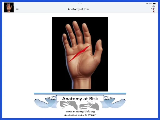 Скриншот 8 — Anatomy at Risk