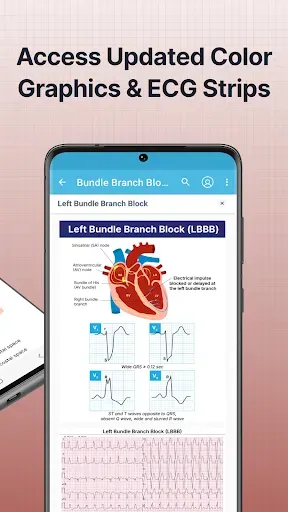 Скриншот 2 — ECG EKG Interpretation Mastery