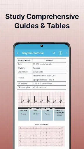 Скриншот 3 — ECG EKG Interpretation Mastery