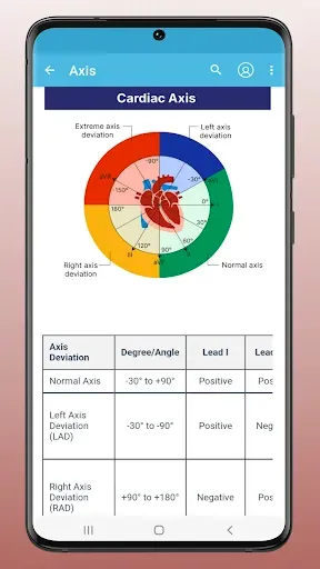 Скриншот 7 — ECG EKG Interpretation Mastery