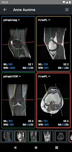 Скриншот 2 — IDV - IMAIOS DICOM Viewer