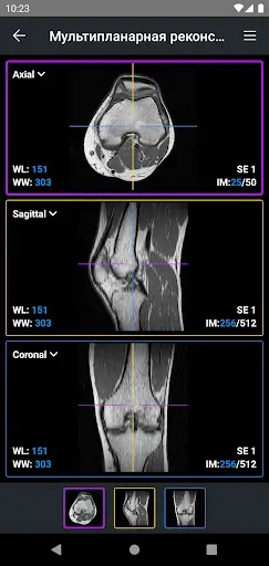 Скриншот 3 — IDV - IMAIOS DICOM Viewer