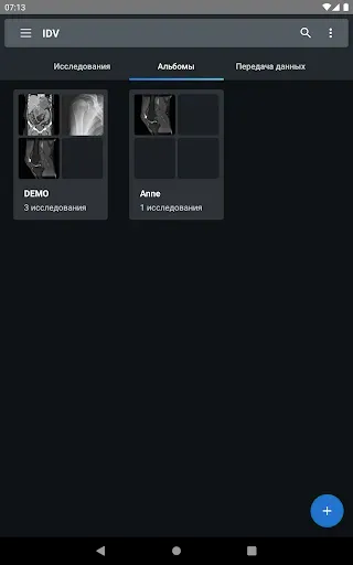Скриншот 6 — IDV - IMAIOS DICOM Viewer