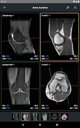 Скриншот 7 — IDV - IMAIOS DICOM Viewer