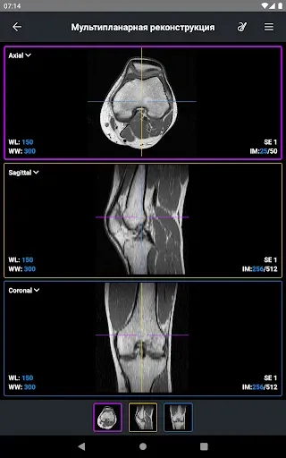 Скриншот 8 — IDV - IMAIOS DICOM Viewer