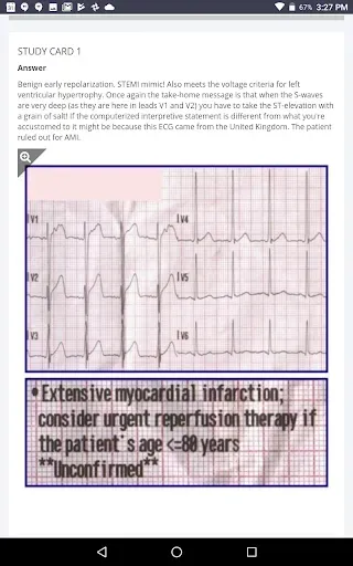 Скриншот 5 — 12-Lead ECG Challenge