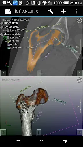 Скриншот 3 — DroidRender - 3D DICOM viewer