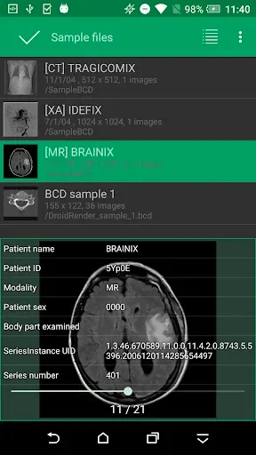 Скриншот 4 — DroidRender - 3D DICOM viewer
