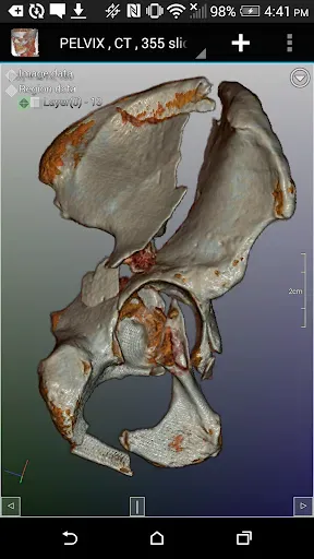 Скриншот 6 — DroidRender - 3D DICOM viewer