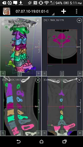 Скриншот 7 — DroidRender - 3D DICOM viewer
