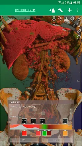 Скриншот 8 — DroidRender - 3D DICOM viewer