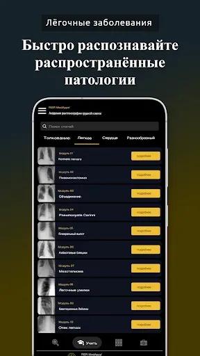 Скриншот 2 — Рентген грудной клетки, РГ ОГК