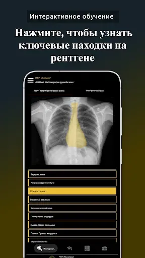 Скриншот 3 — Рентген грудной клетки, РГ ОГК